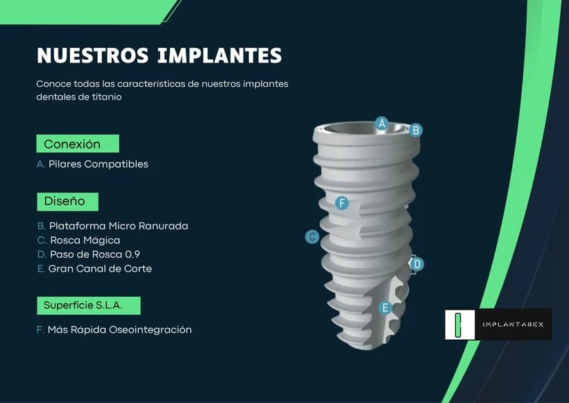 Nuestros implantes dentales