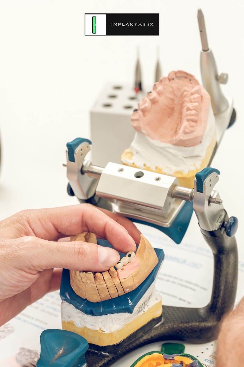 precio protesis dental fija Jaén