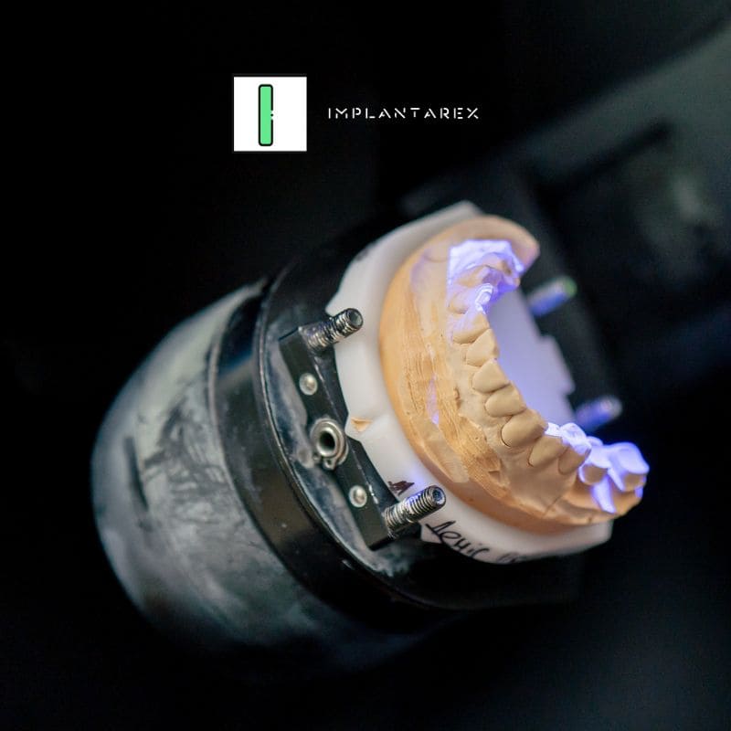 dental prosthesis in Salamanca