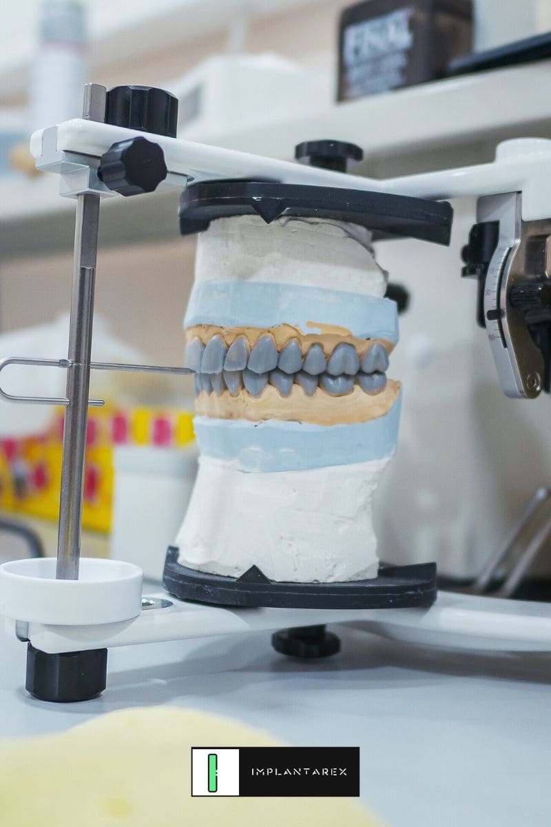 fixed dental prosthesis in Huesca