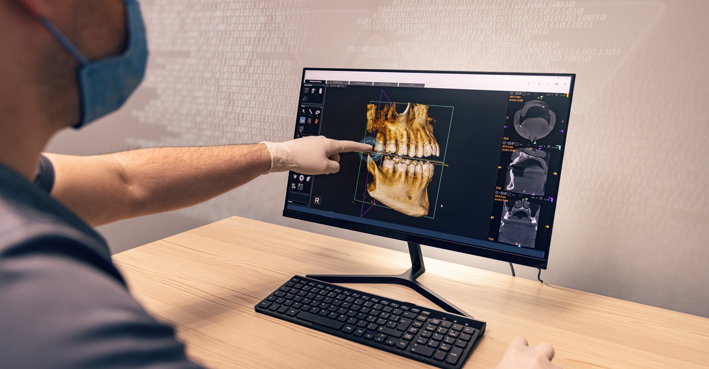 Clinician planning an implant on the 3D scan of the jaw in the guided surgery software