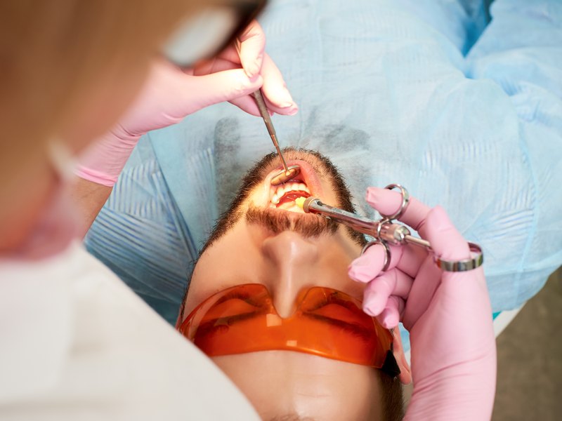 Dentista poniendo anestesia local en la boca de un paciente adulto con gafas protectoras