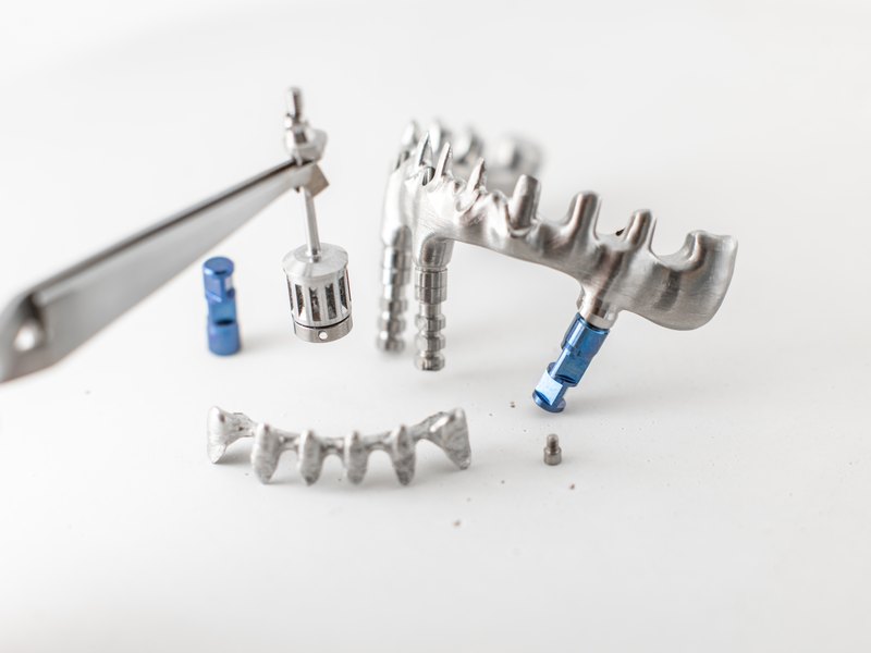 Estructura metálica de una prótesis fija de arcada completa sobre implantes, con sus piezas de unión