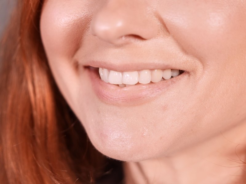Primer plano de la sonrisa de una mujer, con los dientes de delante a la vista